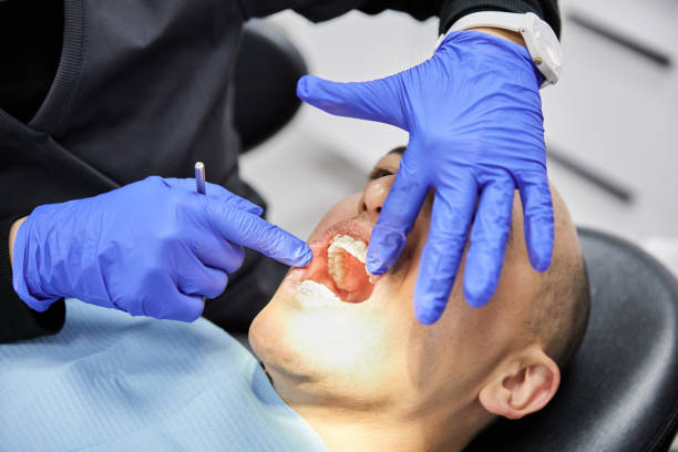 Best Emergency Treatment for Toothache in Stevenson, WA